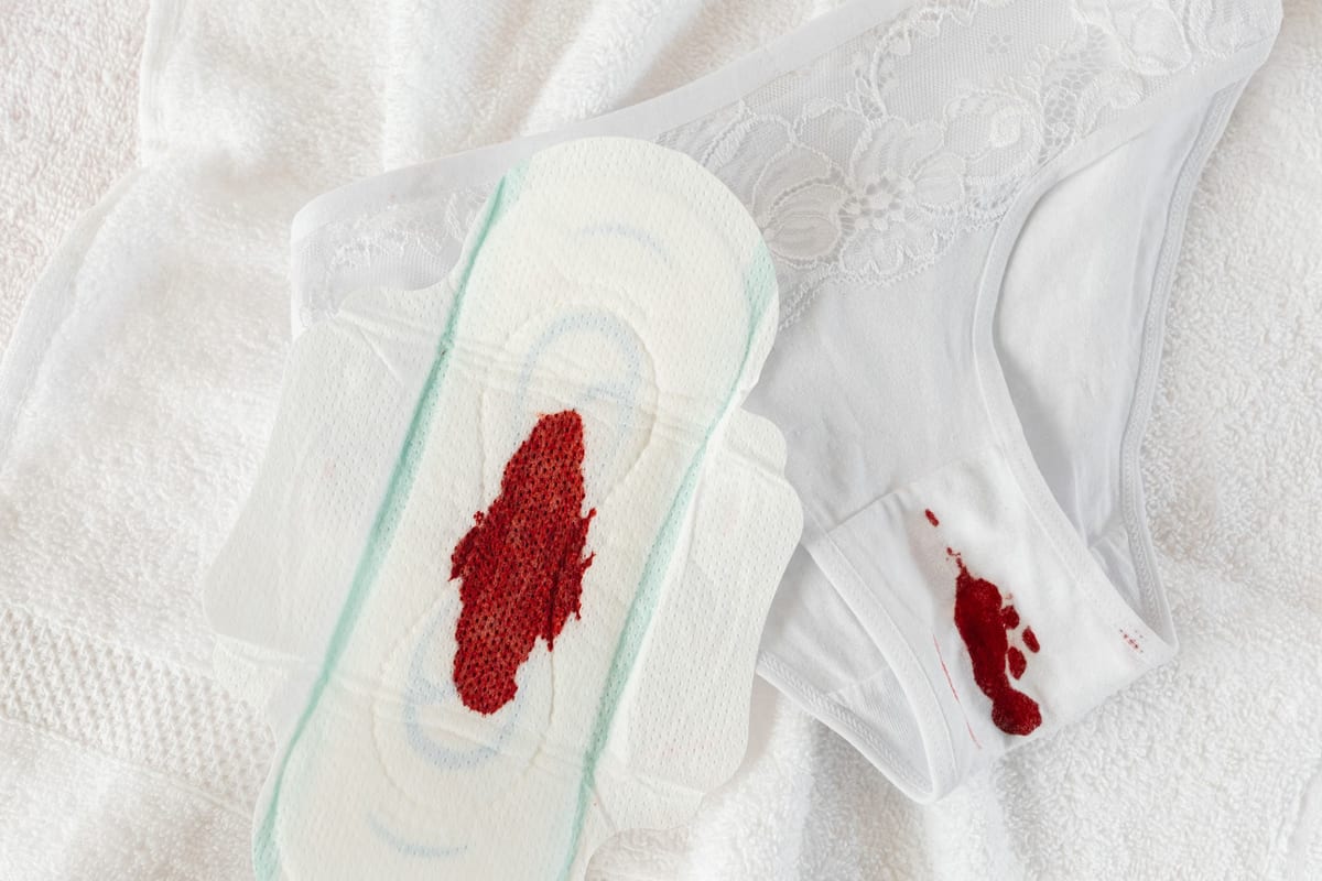 La culotte menstruelle : bonne ou mauvaise idée ?